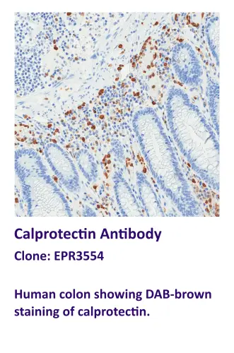 Calprotectin Antibody