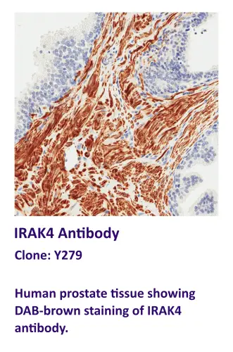 IRAK4 Antibody