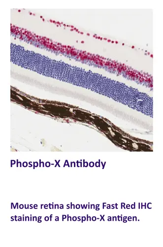 Phospho-X Antibody