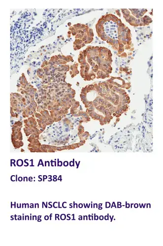 ROS1 Antibody