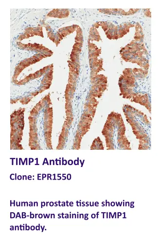 TIMP1 Antibody