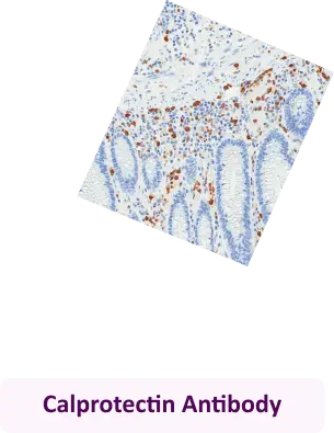 Calprotectin Antibody