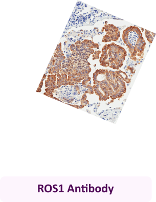 ROS1 Antibody