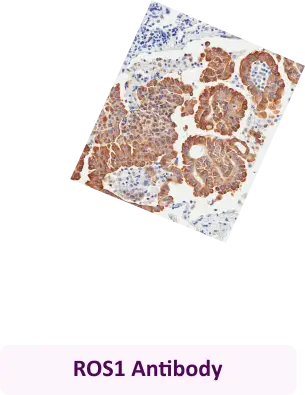 ROS1 Antibody
