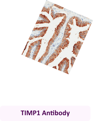 TIMP1 Antibody