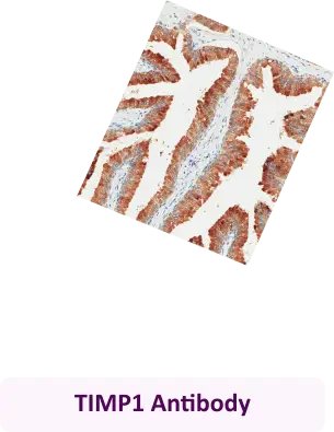 TIMP1 Antibody