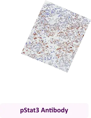 pStat3 Antibody
