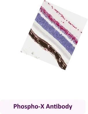 Phospho-X Antibody