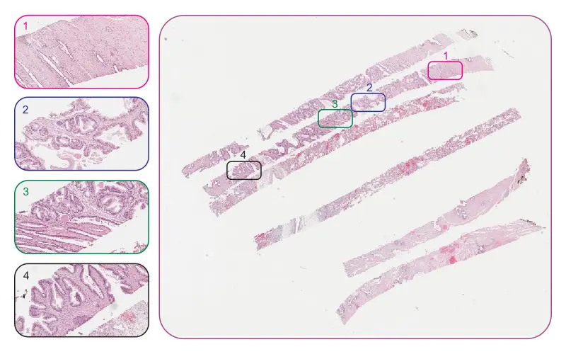 "Slice of Life" Tissue technique