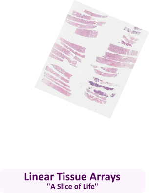 Linear Tissue Arrays - A Slice of Life